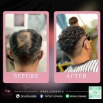 วิกผมผู้ชายติดกาว - ร้านวิกผมติดกาวผู้ชาย ช่างองุ่น - Dara Hairwig