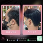 วิกผมผู้ชายเหมือนจริง - ร้านวิกผมติดกาวผู้ชาย ช่างองุ่น - Dara Hairwig