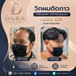 วิกผมสำหรับคนหัวล้าน - Dara Hairwig
