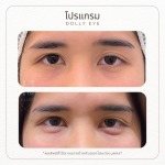 Dolly eye รัชดา - บริษัท เคเจ คลินิก จำกัด