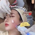 โปรแกรมหน้าใส รัชดา - บริษัท เคเจ คลินิก จำกัด