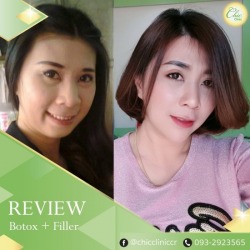 Filler เชียงราย