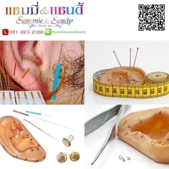 คลินิกฝั่งเข็มช่วยลดน้ำหนัก ใกล้ฉัน คลินิกฝั่งเข็มช่วยลดน้ำหนัก ใกล้ฉัน  คลินิกฝั่งเข็มช่วยลดน้ำหนักปิ่นเกล้า  คลินิกฝั่งเข็มช่วยลดน้ำหนักราคาถูก 
