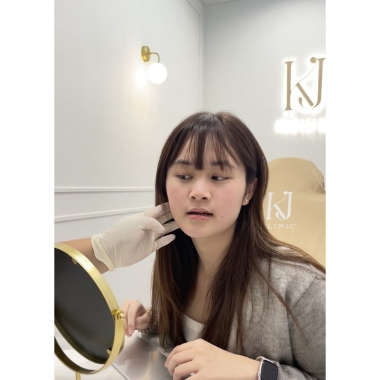 ฉีดโบท็อกรัชดา ฉีดโบท็อกรัชดา  ฉีดโบท็อกอินทามระ  Botox ราคาถูก  โปรแกรมหน้าใส รัชดา  โปรแกรมหน้าใส อินทามระ  รักษาฝ้า รัชดา  รักษาฝ้า อินทามระ  รักษาสิว รัชดา  วิตามินผิว รัชดา  เสริมจมูก รัชดา 